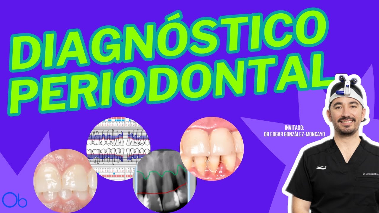 Diagnóstico Periodontal con Dr Edgar González-Moncayo @periodoncistachihuahua