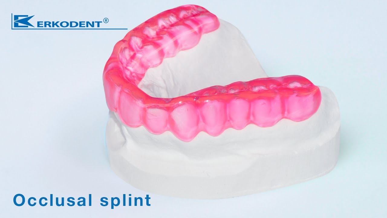 Occlusal splint / bruxism splint