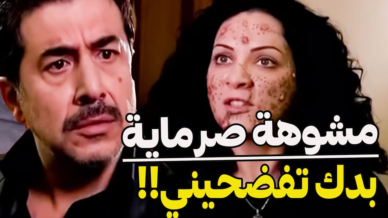 رؤوف المجرم السفاح حرق وش البنت بالأسيد وطمص ع الحادثة  طلعت عنيدة  جئرة ماسكتت لآخدت حقها