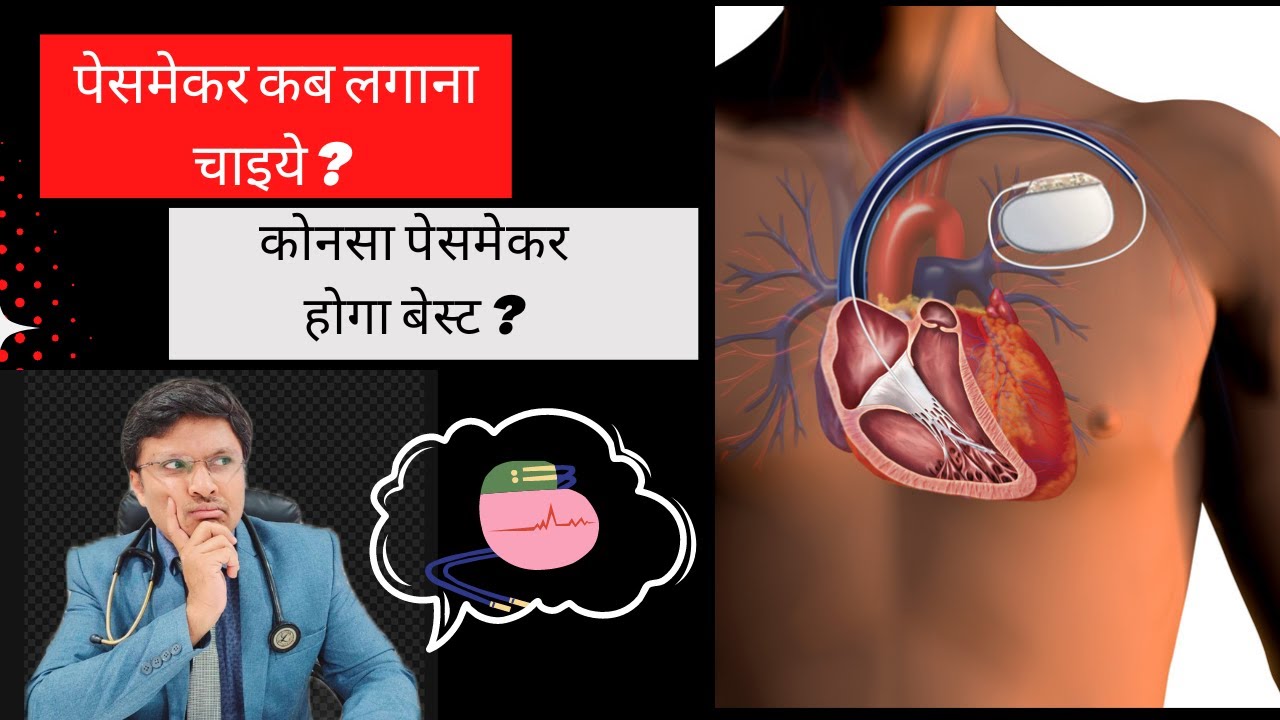 Understanding Different Types of Pacemakers(cardiac devices)