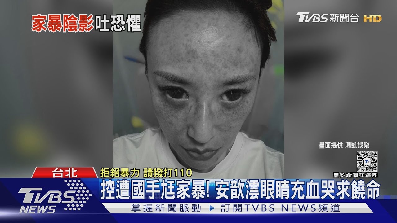 控國手尪出軌+家暴!安歆澐「車裡被掐脖.眼睛充血」請求饒命｜TVBS新聞 @TVBSNEWS01