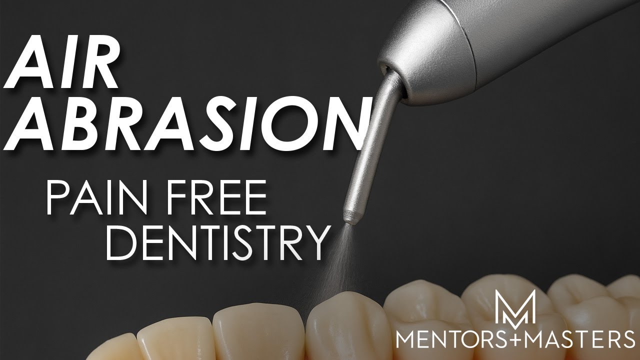 Air Abrasion: The Future of Minimally Invasive, Pain-Free Dentistry | Mentors & Masters