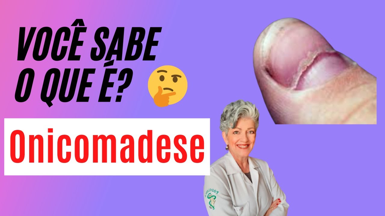 Onicomadese Saiba O Que É