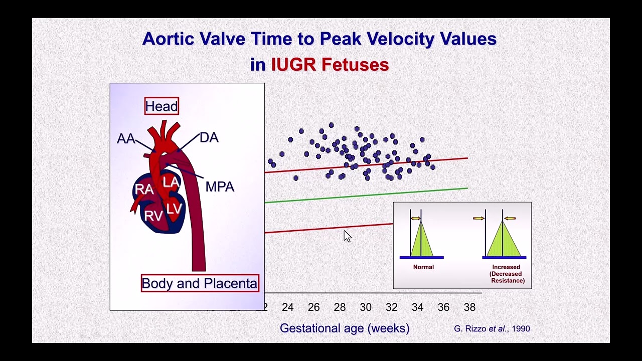 Hemodynamics in IUGR fetuses