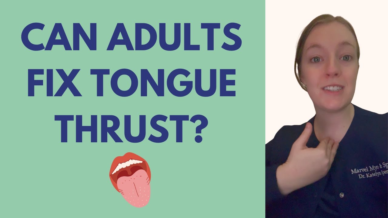 Can Adults Fix Tongue Thrust?