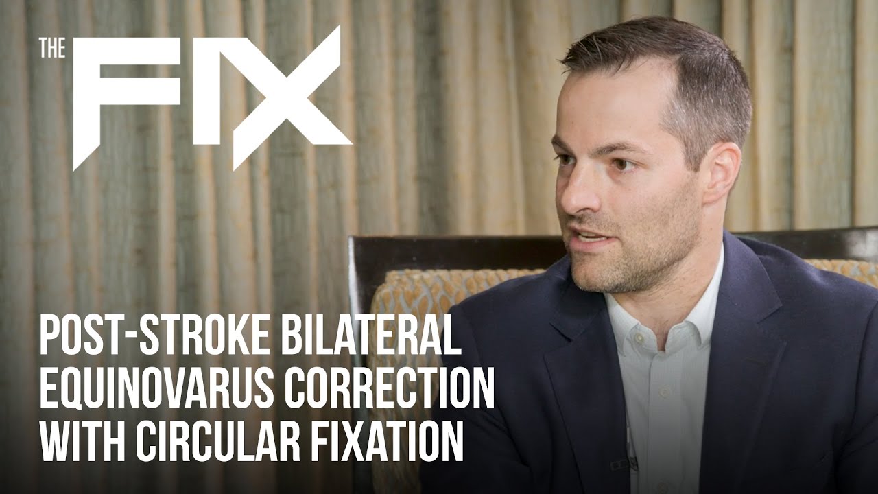 The FIX with Dr. D. Frumberg – Post-Stroke Bilateral Equinovarus Correction with Circular Fixation