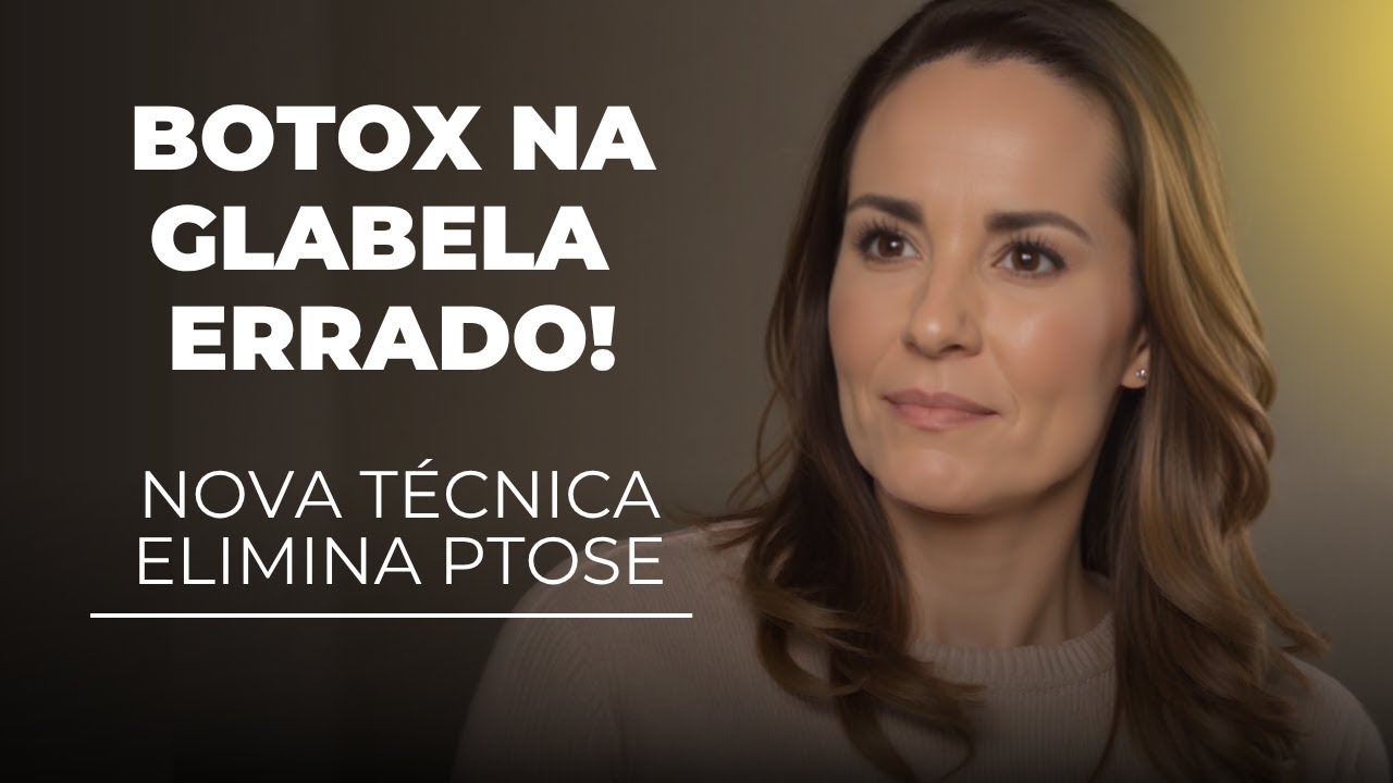 BOTOX NA GLABELA Errado! Nova Técnica Elimina Risco de Ptose
