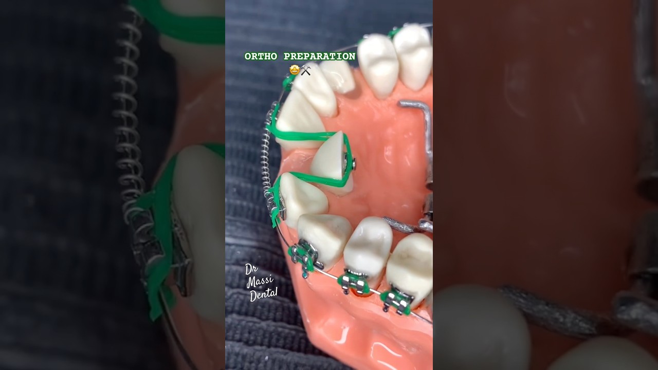 ОРТО ПОДГОТОВКА 🦷😬