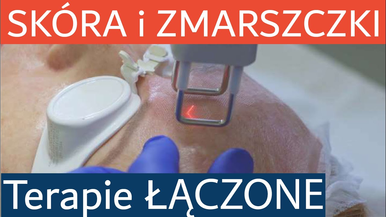 Zabiegi laserowe na twarz, szyję i dekolt - przebudowa skóry i redukcja zmarszczek
