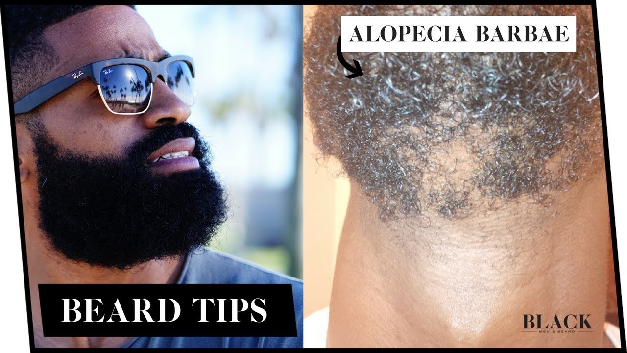 Alopecia Barbae | Beard Symptoms, Causes, Treatments | Beard Patches
