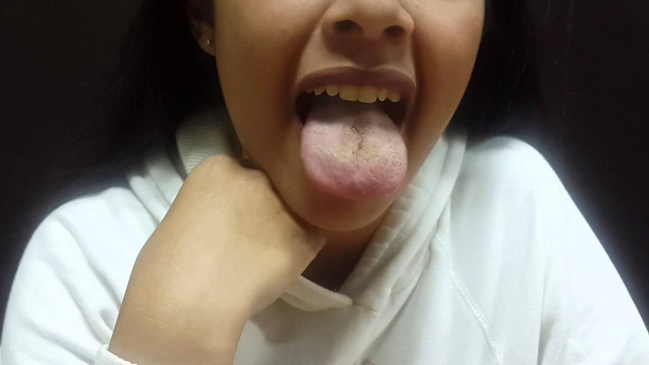 Tongue tricks