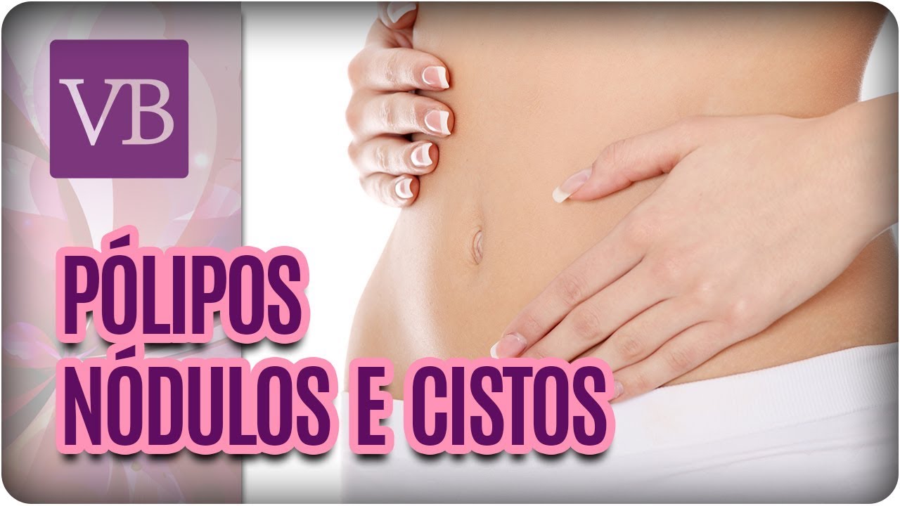 Pólipos, Nódulos e Cistos - Você Bonita (09/11/17)