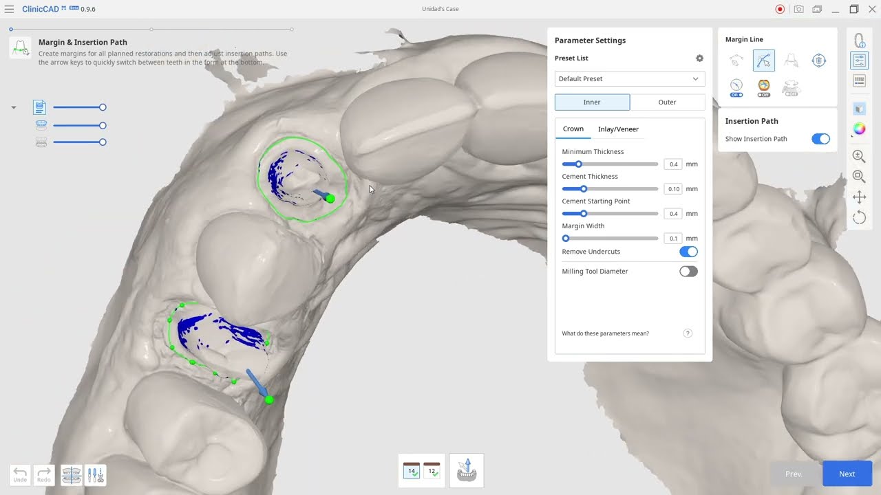 Medit Clinic CAD - Herramientas y Basicos