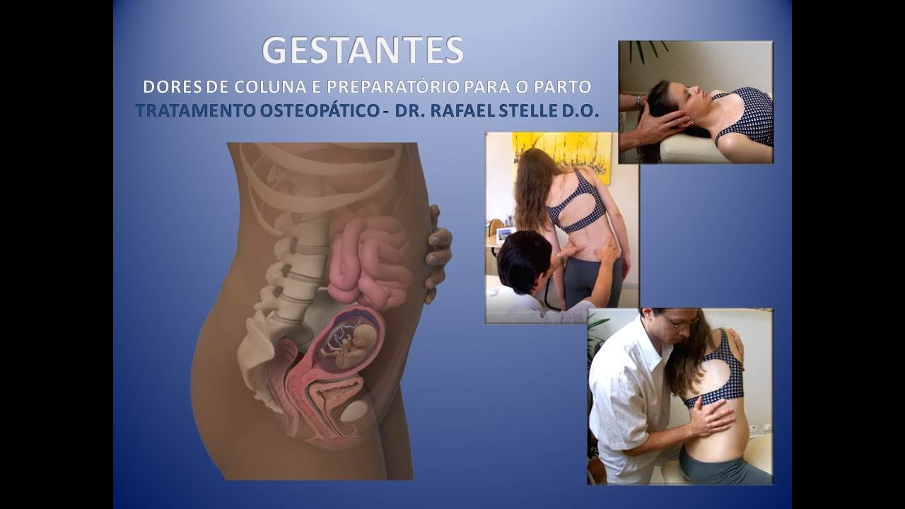 GESTANTES - DORES DE COLUNA / PREPARATÓRIO PARA O PARTO: Tratamento manipulativo osteopático