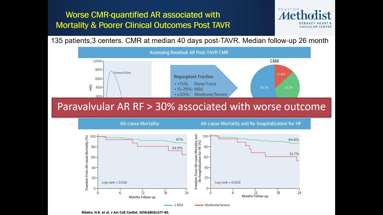 2.24.26 Multi-Modality Imaging Weekly Webcast