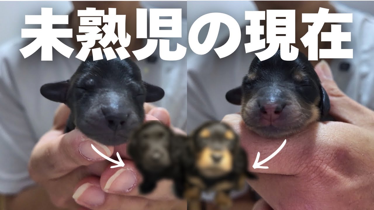 壮絶な出産を経て産まれた未熟児達、生後40日を超えた今…