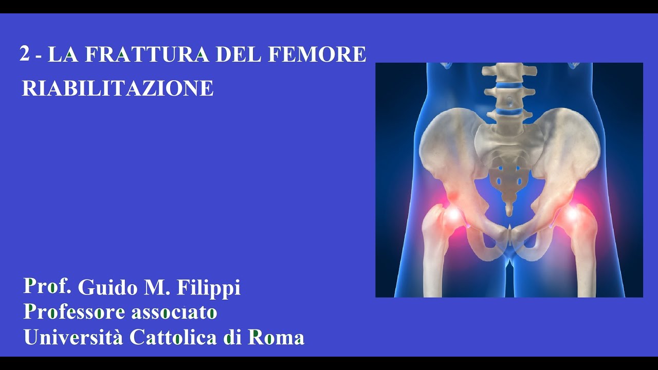 2-IL RECUPERO DOPO LA FRATTURA DEL FEMORE