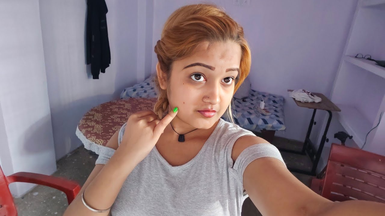 Dekhiye Guy's Mere Gaal Pe kya kat Liya , 😟