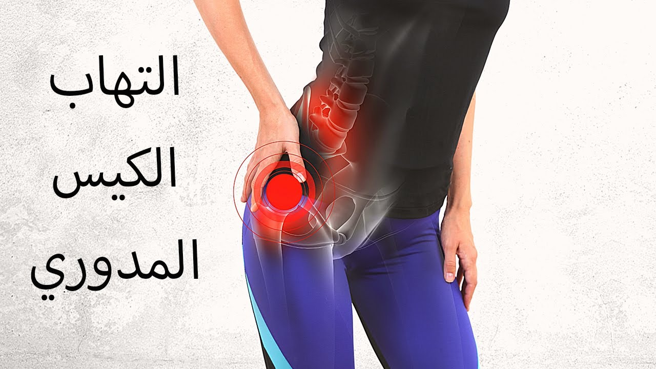 التهاب الكيس (الجراب) المدوري - Trochanteric Bursitis