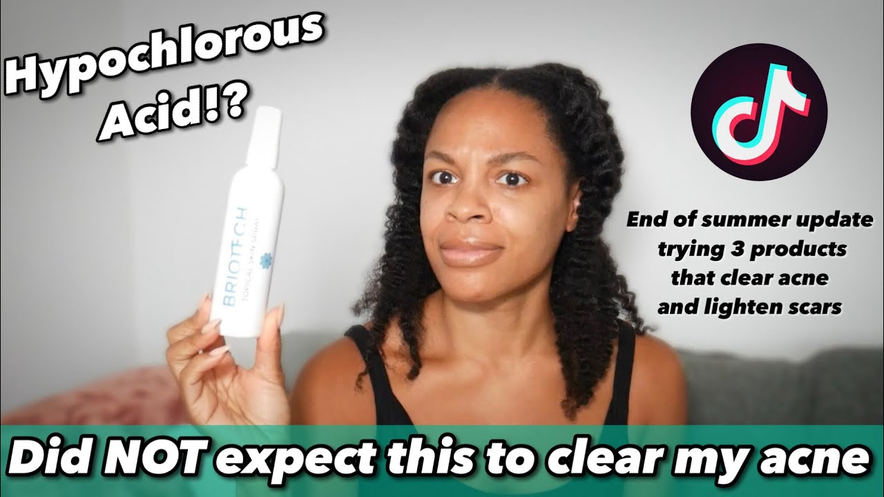 HYPOCHLOROUS ACID clears my acne | tiktok viral| 3 MONTH UPDATE ACNE Products that clear your skin