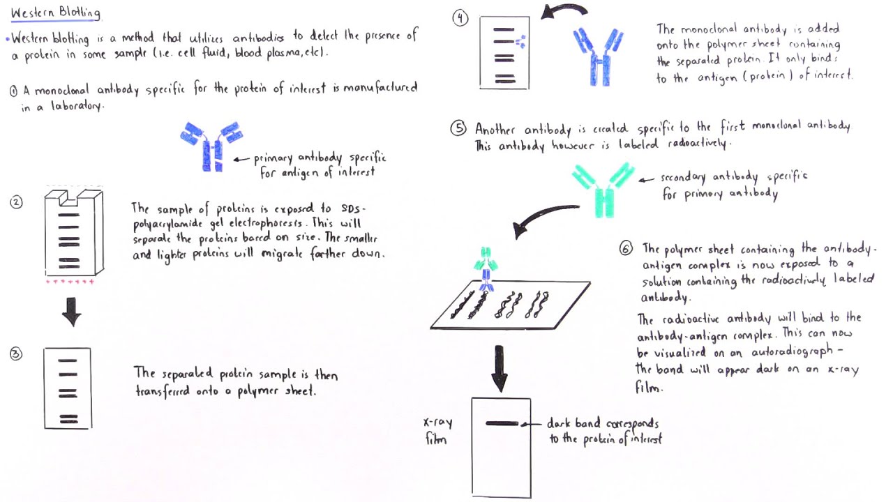 Western Blotting