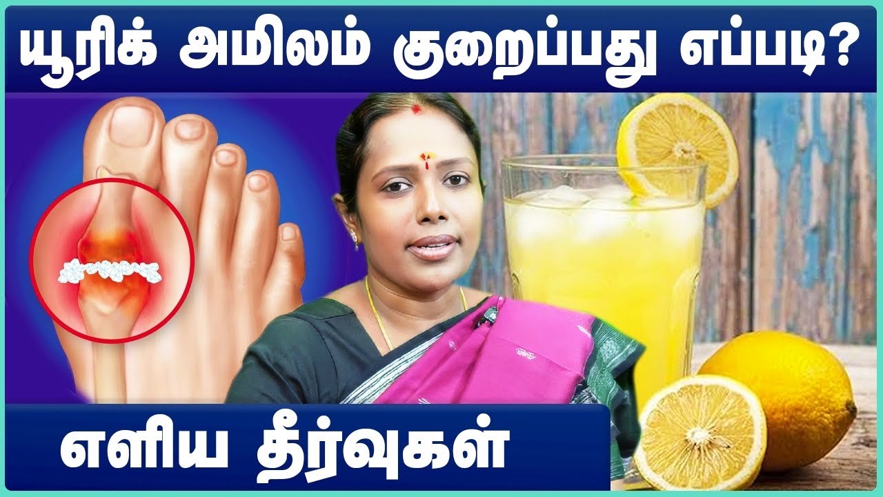 யூரிக் அமிலம் குறைப்பது எப்படி? | How to Lower URIC ACID | How to reduce high Uric Acid level