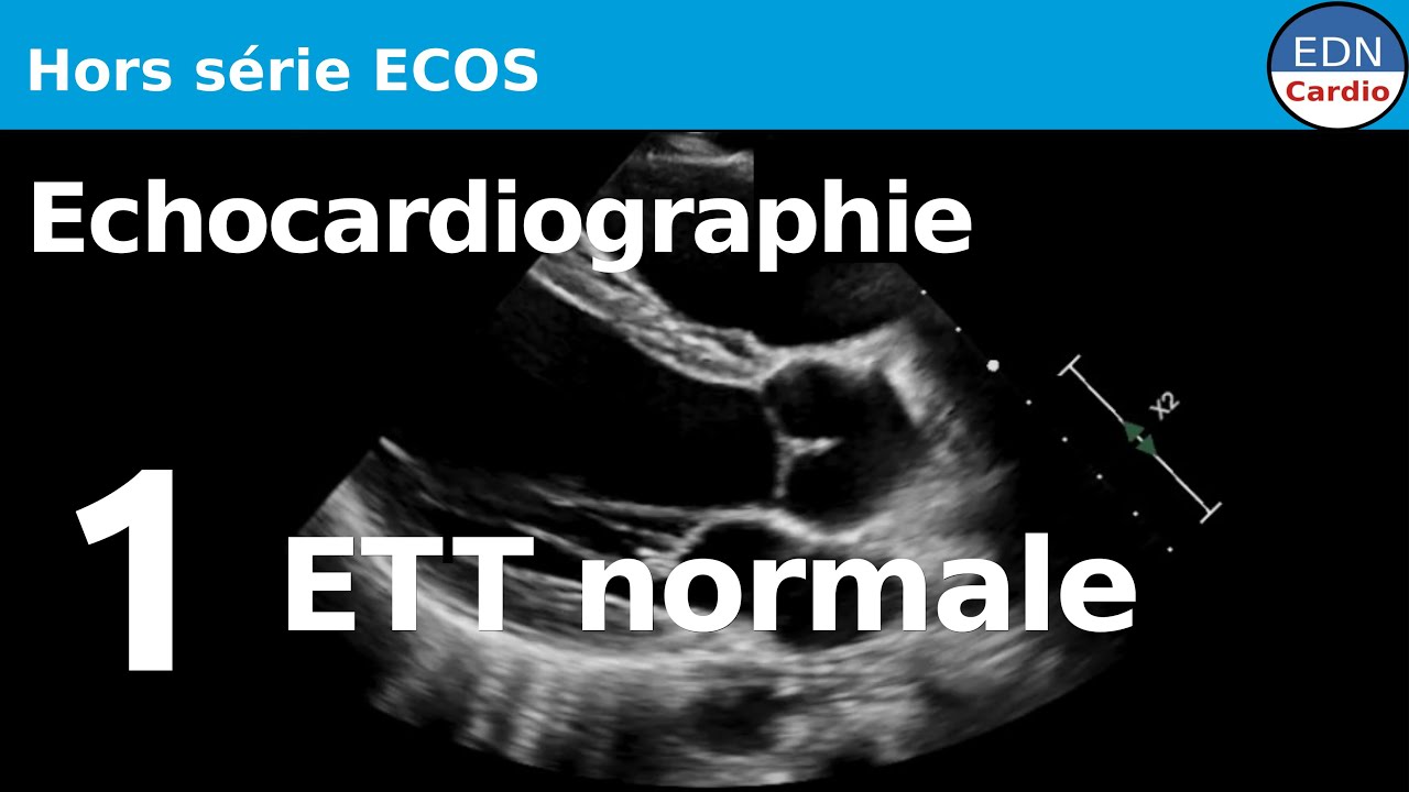 Hors série ECOS - Echocardiographie - 1. ETT normale : coupes, structures...