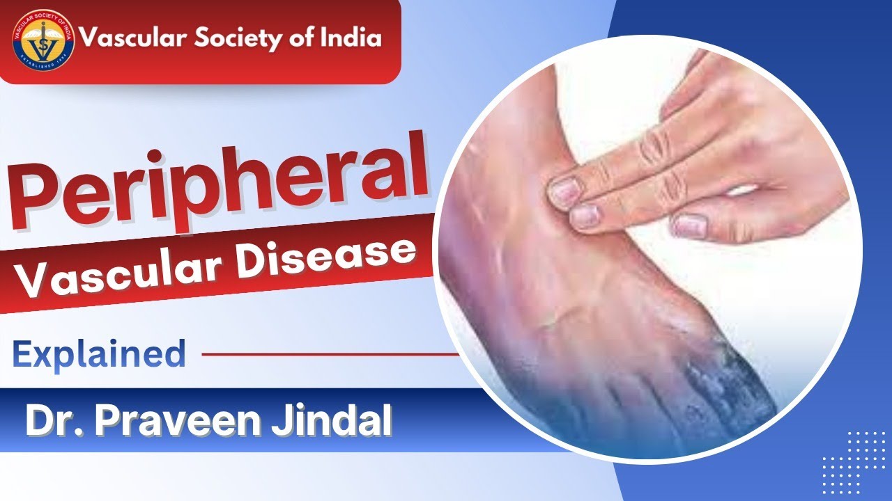 Peripheral Vascular Disease Explained by Dr. Parveen Jindal | Causes, Symptoms & Warning Signs