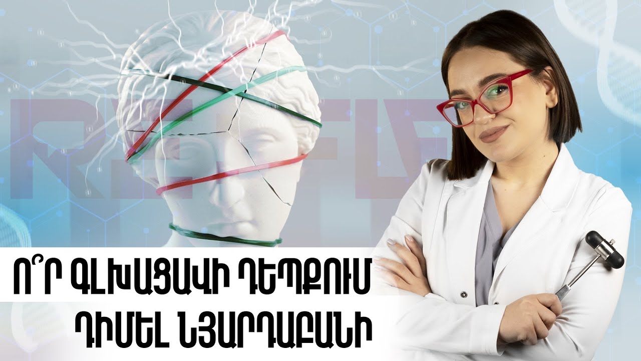 Գլխացավ | Reflex 02