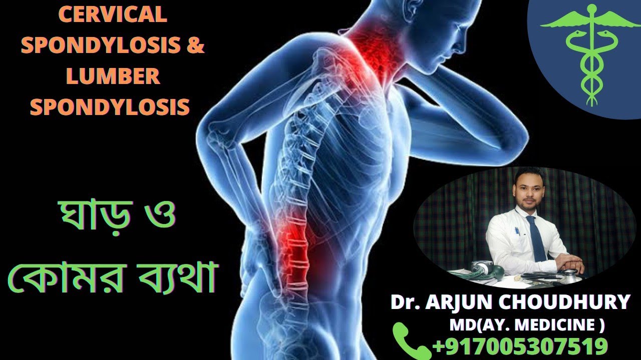 SPONDYLOSIS #Dr. ARJUN CHOUDHURY #AYURVEDIC