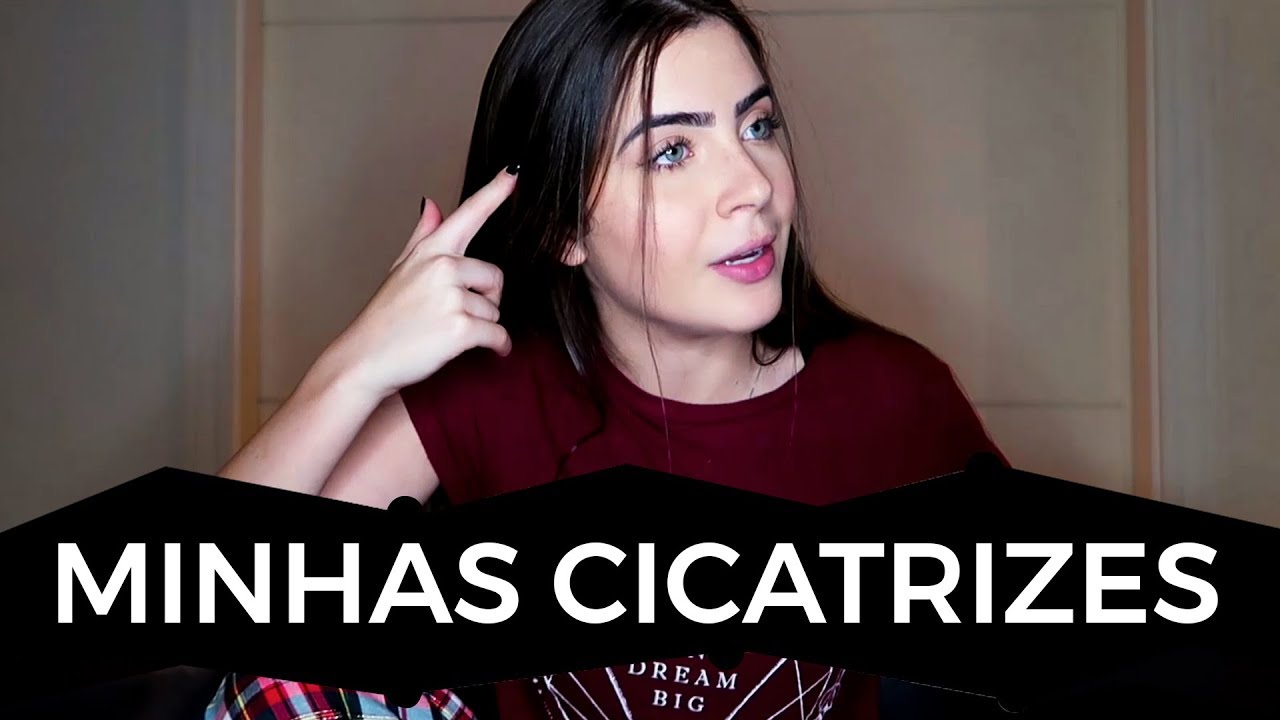 A história das minhas cicatrizes