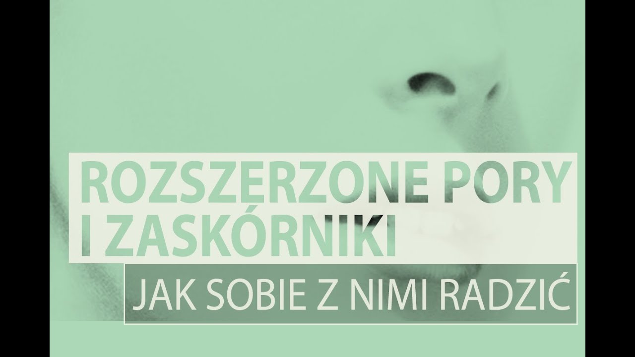 Rozszerzone pory i zask&oacute;rniki