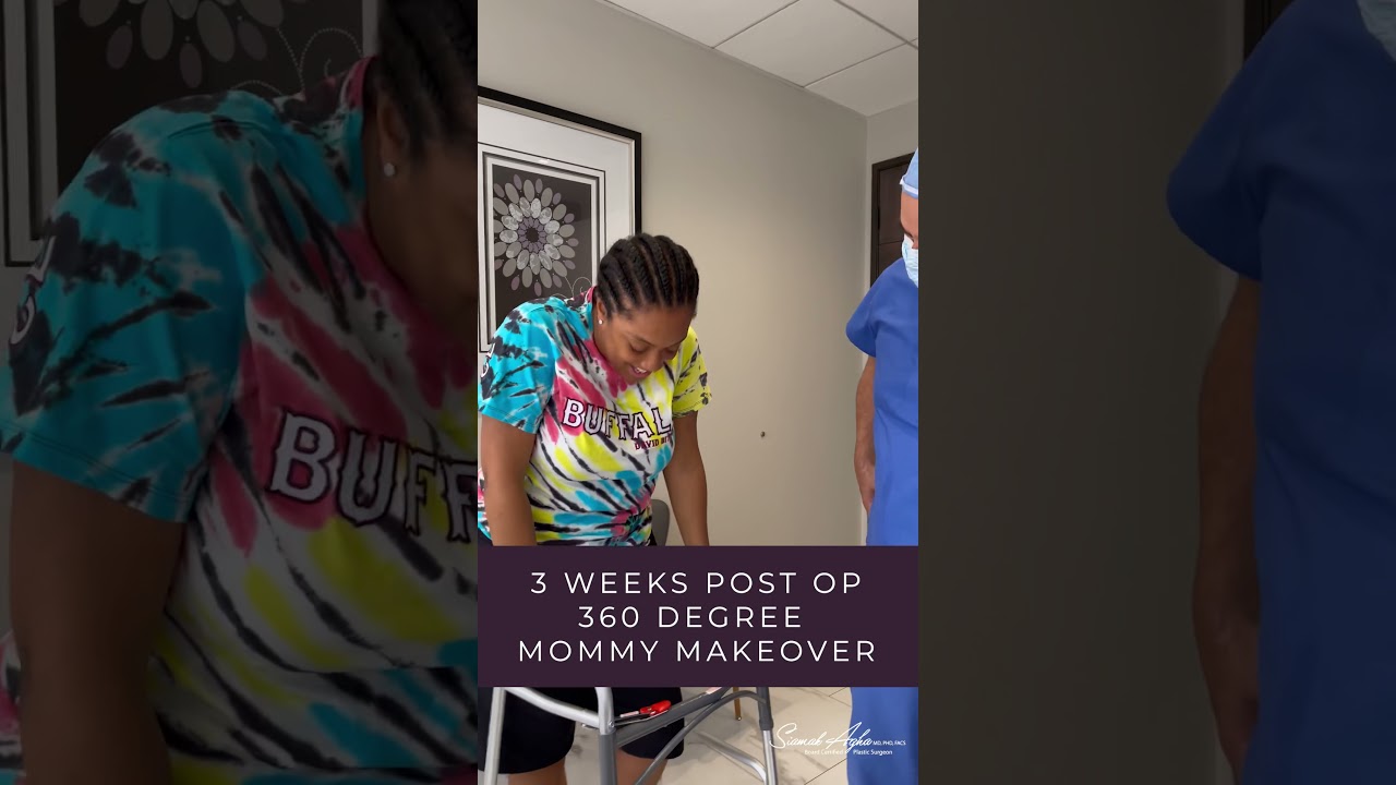 360° Mommy Makeover - 3 Weeks Post Op + Before & After