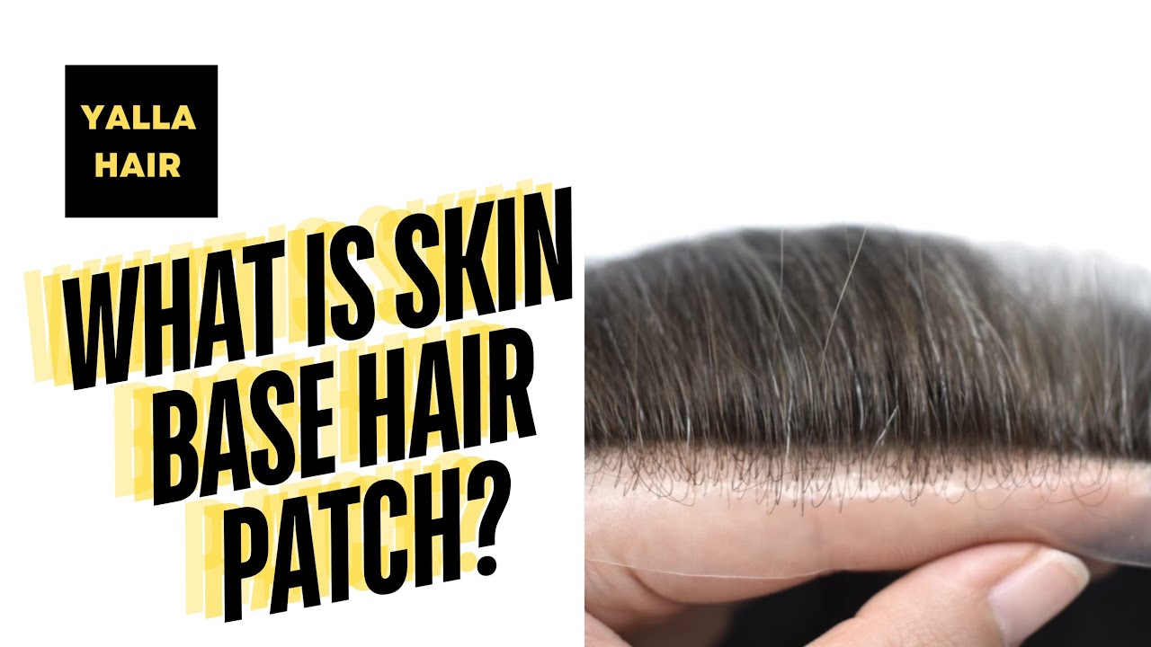 What is Skin or PU Base Hair System? #hairpatch #hairreplacementsystem  #hairreplacement #hairsystem