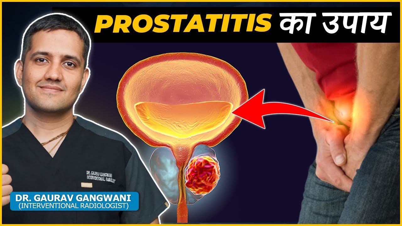 Best Treatment and Diagnosis for Prostatitis | Dr. Gaurav Gangwani (Interventional Radiologist)