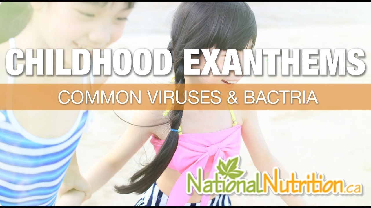 Natural Health Reviews - Common Childhood Exanthems & Treatements | National Nutritions