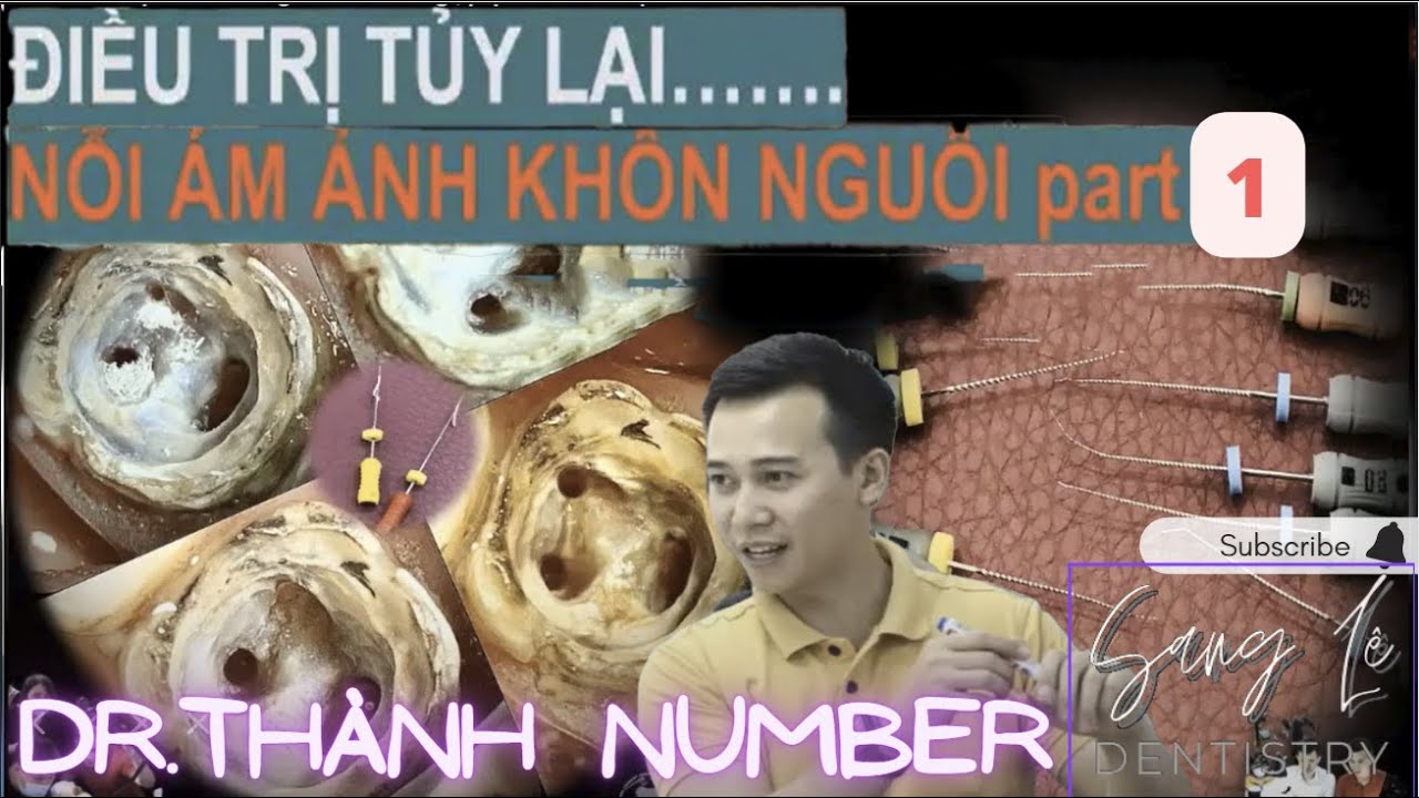 NHỮNG KHÓ KHĂN KHI ĐIỀU TRỊ TỦY P1 | Nội Nha Thực Chiến Dr Thành Number - Woodpecker Courses No.134