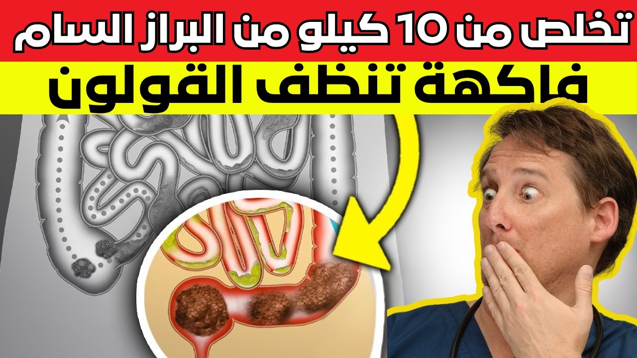 سر الطبيب العبقري أفضل فاكهة لعلاج الإمساك وتطهير القولون_ التغذية العلاجية تخلص من 10كلغ من الفضلات