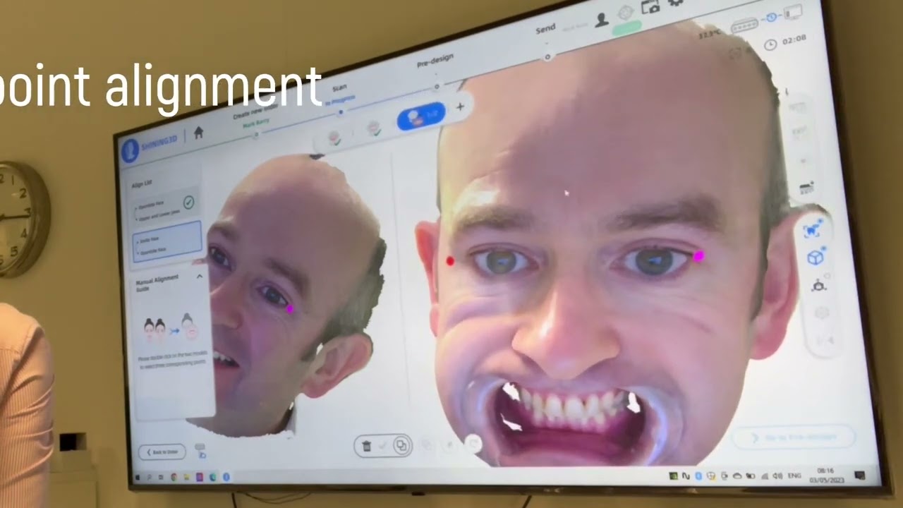 Shining 3D Dental MetiSmile Demonstration by ESM Digital Solutions