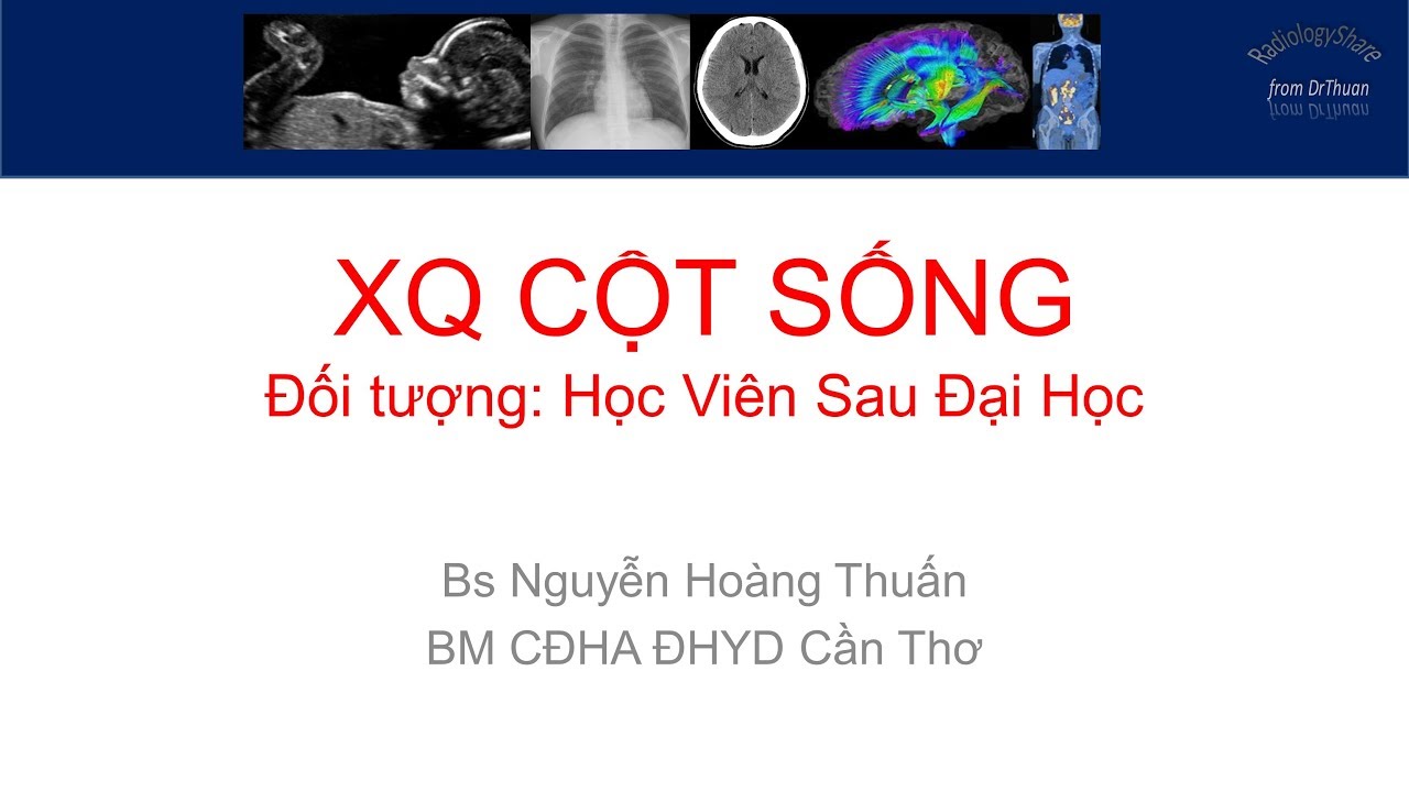 X quang cot song Phan3 Benh Ly