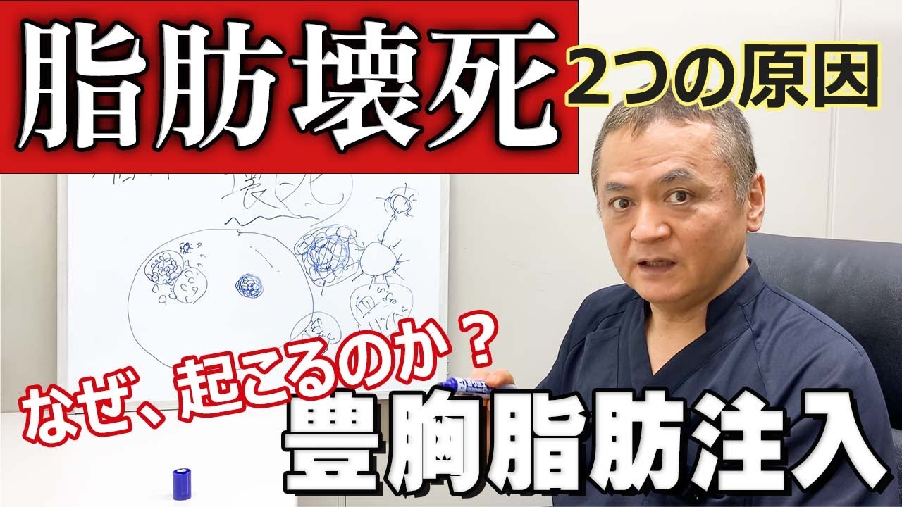 【豊胸】脂肪壊死が起こる理由→脂肪の量に問題があるって知ってる？自分の身を守る為にも知っておきたい事！