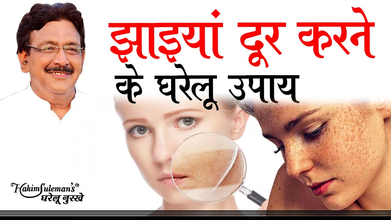 चेहरे की झाइयां दूर करने के आसान घरेलू उपाय