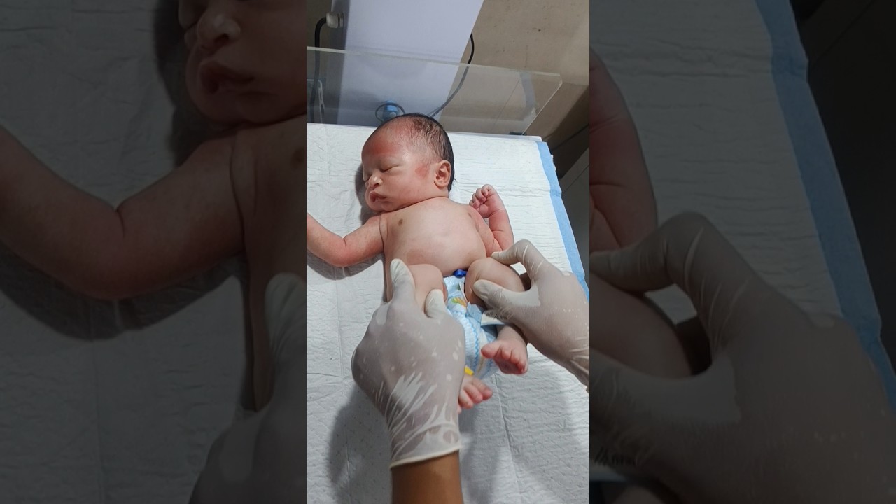 Physiotherapy Care for Newborn with Birth Asphyxia💆&zwj;♀️ | NICU Delay Cry Baby Car🩺👶
