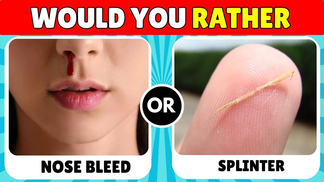 Would You Rather..! Hardest Choices Ever 😱😵‍💫😵/ 100 Impossible Choices