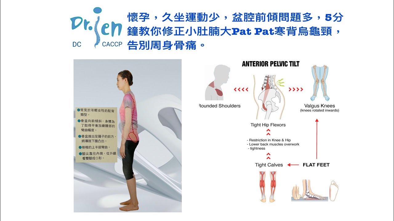 懷孕，久坐運動少，盆腔前傾問題多，5分鐘教你修正小肚腩大Pat Pat寒背烏龜頸，告別周身骨痛。5min Correct Anterior Pelvic Tilt
