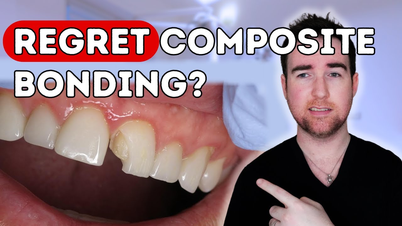 What Dentists Really think of Composite Bonding