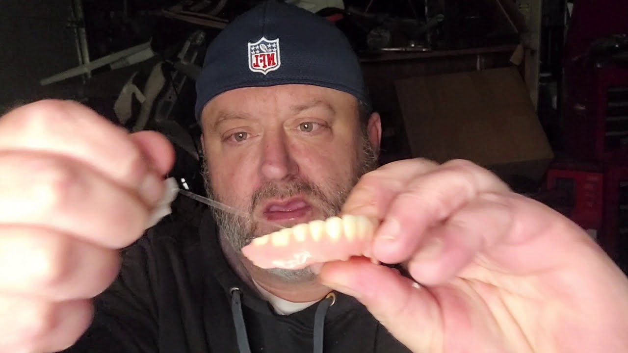 How to apply reline-it in a bottom denture.