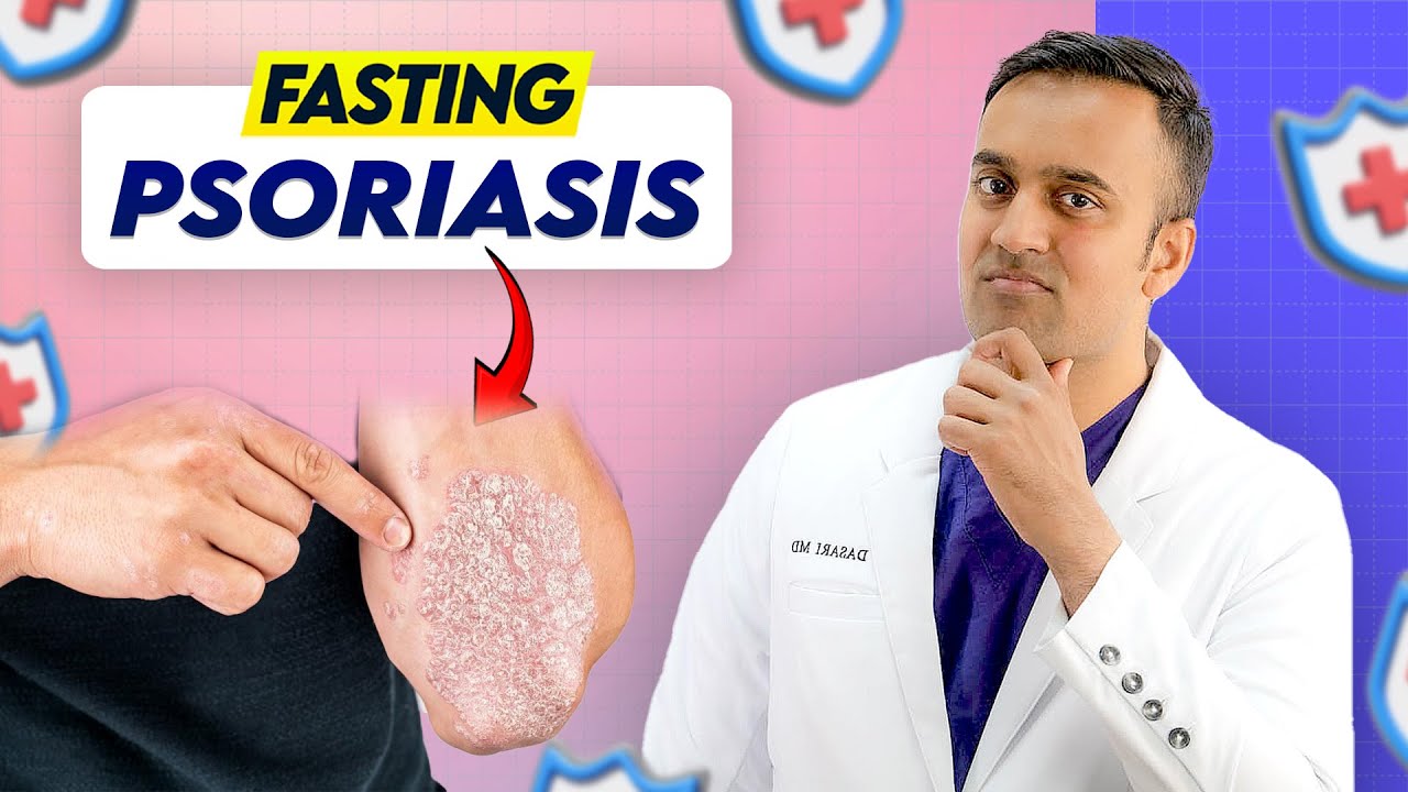 Intermittent Fasting, OMAD, Ketosis, Autophagy  for Psoriasis: Medical Doctor Explains Pro/Cons