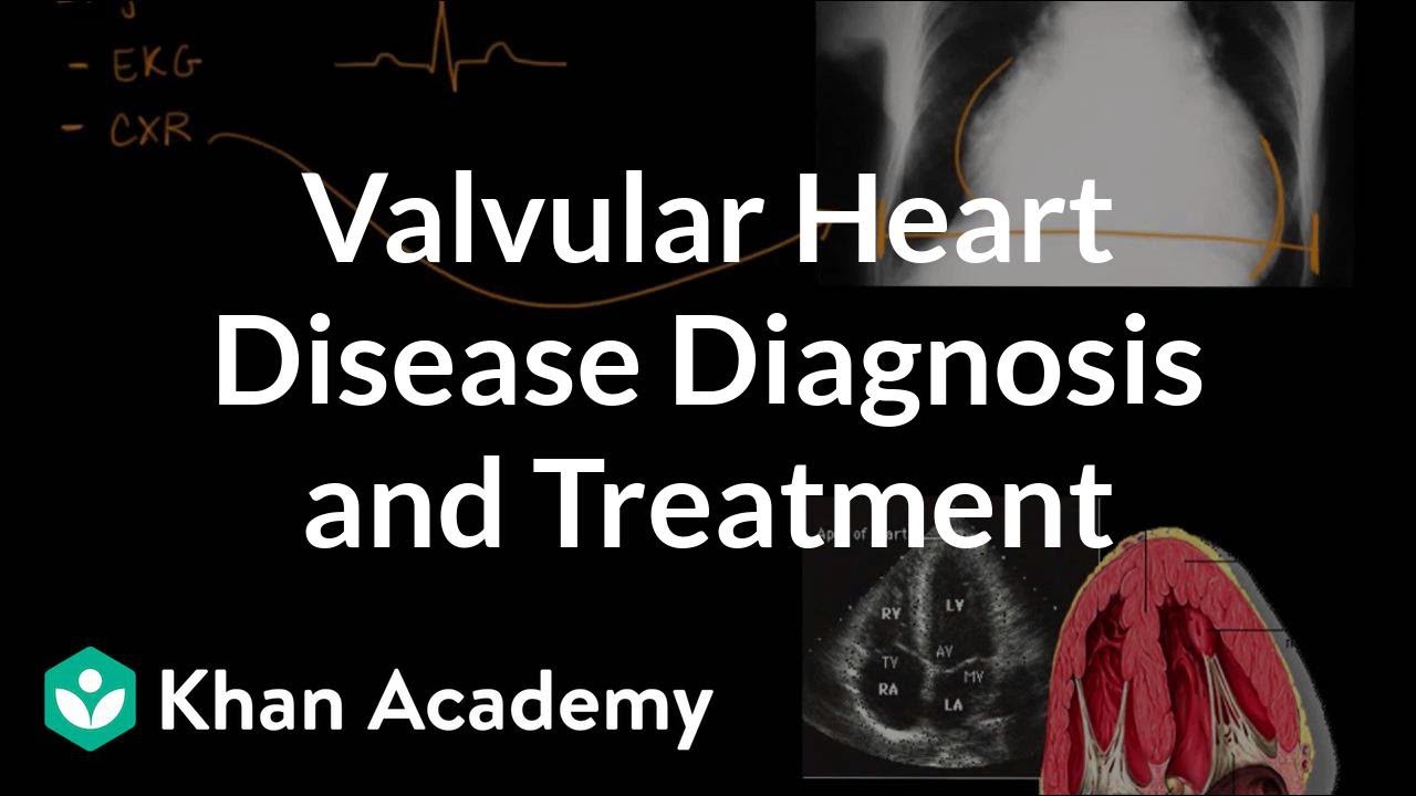 Valvular heart disease diagnosis and treatment | NCLEX-RN | Khan Academy