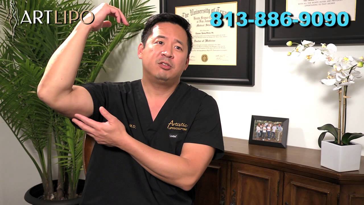 Arm Lift Liposuction Tampa, Sarasota, Orlando - Celebrity Arms | Expert Dr. Su